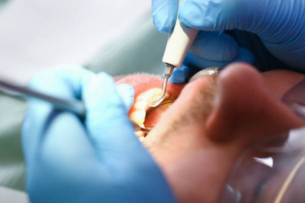 Best Emergency Root Canal Treatment in Raoul, GA