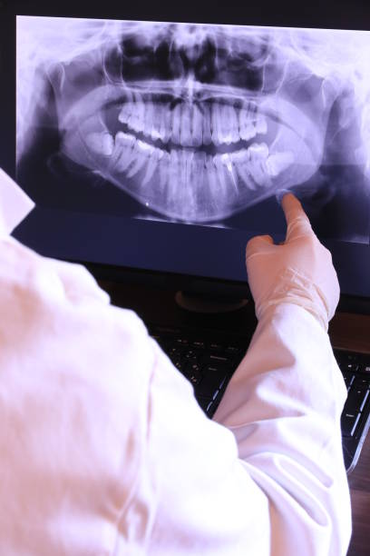 Best Emergency Treatment for Dental Infections or Abscesses in Raoul, GA