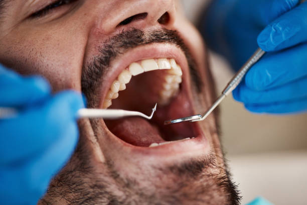 Best Emergency Tooth Extraction in Raoul, GA