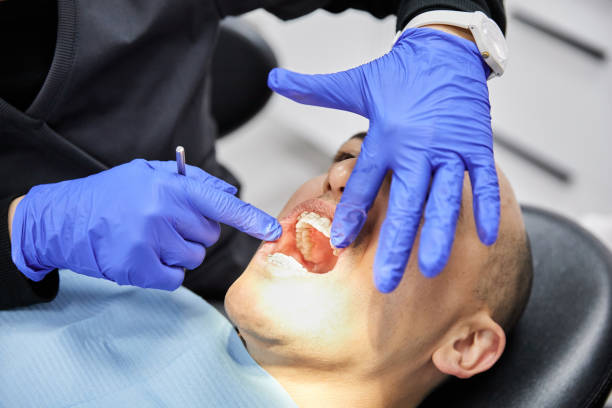 Best Emergency Tooth Extraction in Raoul, GA